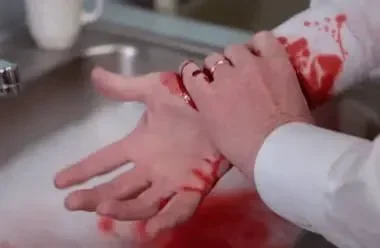 Controle de hemorragias